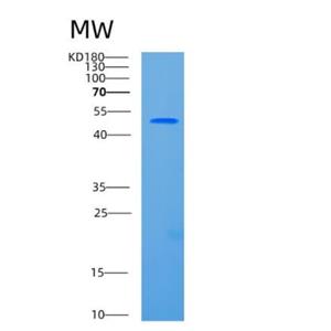 Recombinant Human CCBL1 Protein,Recombinant Human CCBL1 Protein