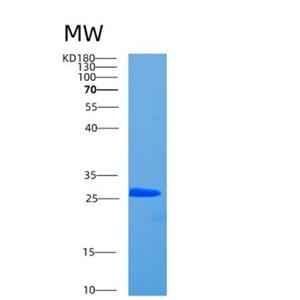 Recombinant Human CCDC25 Protein,Recombinant Human CCDC25 Protein