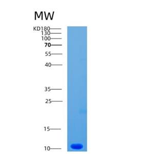 Recombinant Human CCL1 Protein,Recombinant Human CCL1 Protein