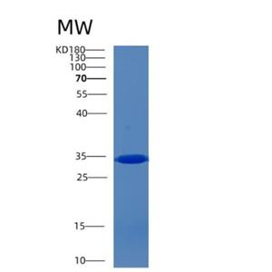 Recombinant Human CCM2 Protein