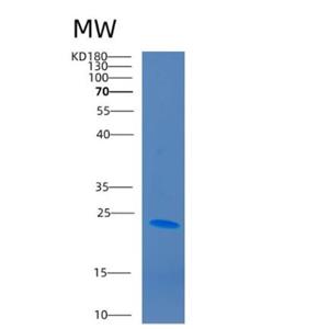 Recombinant Human CD2 Protein