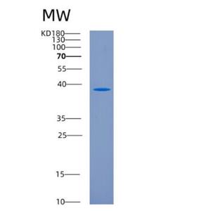 Recombinant Human CD207 Protein,Recombinant Human CD207 Protein