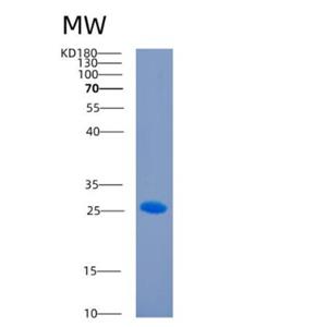 Recombinant Human CD244 Protein
