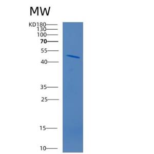 Recombinant Human CD320 Protein,Recombinant Human CD320 Protein