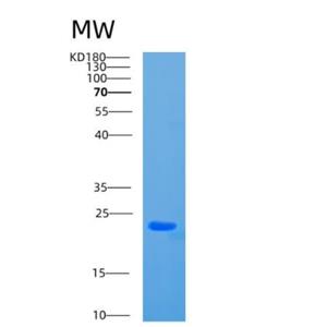 Recombinant Human CBX3 Protein,Recombinant Human CBX3 Protein