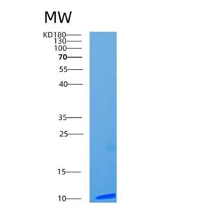 Recombinant Human CCL13 Protein