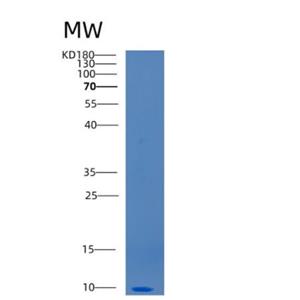 Recombinant Human CCL20 Protein,Recombinant Human CCL20 Protein