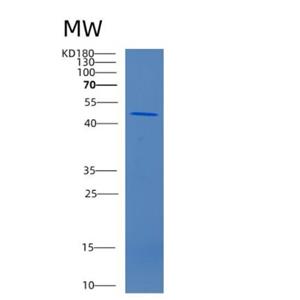 Recombinant Human CCN1 Protein