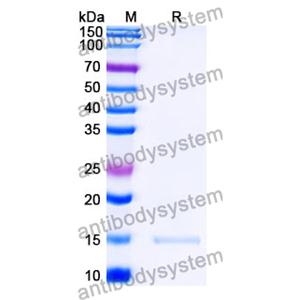 抗 SARS-CoV-2 S Protein 納米抗體 (SAA1101)(RVV00179),Anti-SARS-CoV-2 S Protein Nanobody (SAA1101)