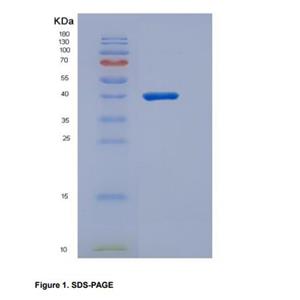 Eukaryotic Cluster Of Differentiation 200 (CD200)