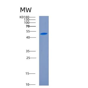 Recombinant Human CD27 Protein,Recombinant Human CD27 Protein