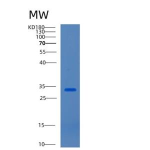 Recombinant Mouse Cathepsin Z Protein