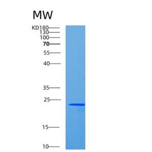 Recombinant Human CCDC90B Protein