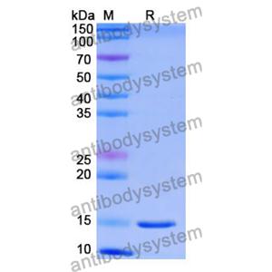 Anti-Human FOLH1/PSMA Nanobody (SAA1352)