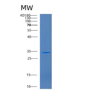 Recombinant Human CD1B Protein,Recombinant Human CD1B Protein