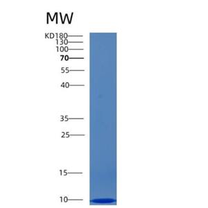 Recombinant Human CCL4L1 Protein