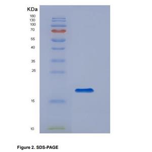 Recombinant Cluster Of Differentiation 14 (CD14)