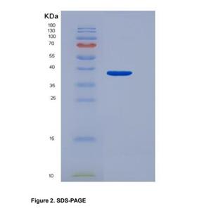Recombinant Programmed Cell Death Protein 1 Ligand 1 (PDL1)