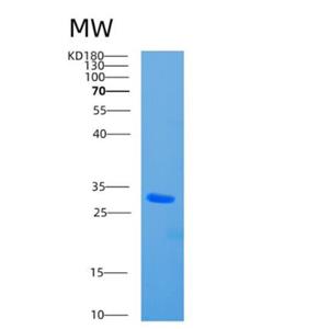 Recombinant Human CBR4 Protein,Recombinant Human CBR4 Protein