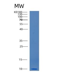 Recombinant Human CCL3 Protein,Recombinant Human CCL3 Protein