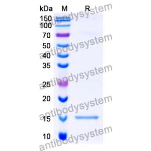 Anti-SARS-CoV-2 S Protein Nanobody (SAA1092)