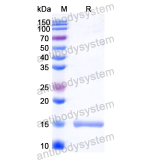 抗 Human CD221/IGF1R 納米抗體 (SAA1314)(RHC29901),Anti-Human CD221/IGF1R Nanobody (SAA1314)