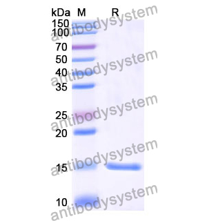 抗 Human CTNNB1 纳米抗体 (SAA1188)(RHE07602),Anti-Human CTNNB1 Nanobody (SAA1188)