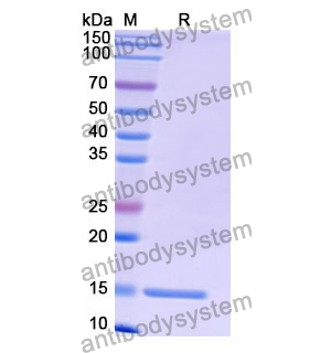 抗 Human OLR1/LOX1 納米抗體 (SAA1291)(RHF66401),Anti-Human OLR1/LOX1 Nanobody (SAA1291)