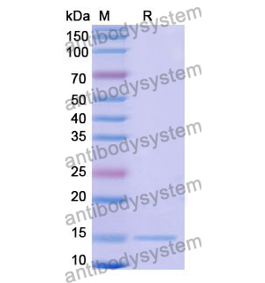 抗 Human CFTR 纳米抗体 (SAA1012)(RHC98303),Anti-Human CFTR Nanobody (SAA1012)