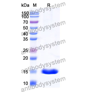 抗 Human CAT/Catalase 纳米抗体 (SAA1202)(RHC05301),Anti-Human CAT/Catalase Nanobody (SAA1202)