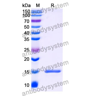 抗 Human CGA 納米抗體 (SAA1210)(RHB92501),Anti-Human CGA Nanobody (SAA1210)