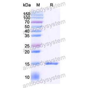 抗 SARS-CoV-2 S Protein 纳米抗体 (SAA1074)(RVV00163),Anti-SARS-CoV-2 S Protein Nanobody (SAA1074)