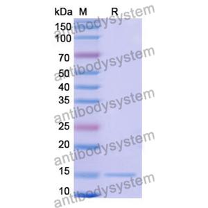 抗 Human CFTR 纳米抗体 (SAA1012)(RHC98303),Anti-Human CFTR Nanobody (SAA1012)