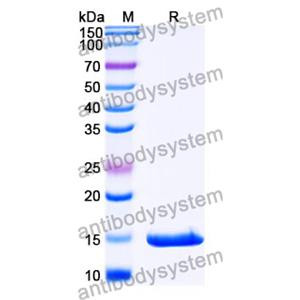 抗 SARS-CoV-2 S Protein 纳米抗体 (SAA1093)(RVV00174),Anti-SARS-CoV-2 S Protein Nanobody (SAA1093)