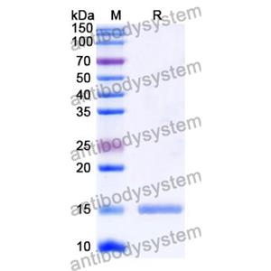 抗 Human H2AX 納米抗體 (SAA1353)(RHD15006),Anti-Human H2AX Nanobody (SAA1353)