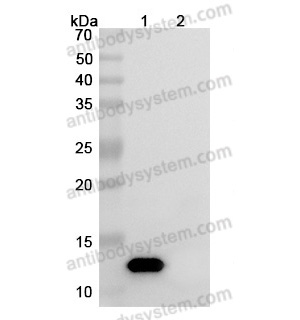 中和抗体-Human IL8/CXCL8 (Iv0023) VHC79101,IL8/CXCL8