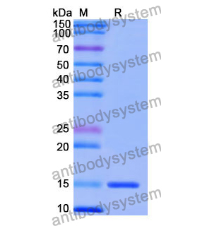 抗 Human CD202b/TEK/TIE-2 纳米抗体 (SAA1254)(RHF95601),Anti-Human CD202b/TEK/TIE-2 Nanobody (SAA1254)