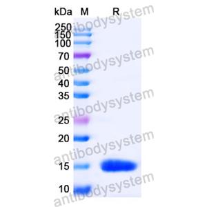 抗 Human CD29/ITGB1 纳米抗体 (SAA1306)(RHC17601),Anti-Human CD29/ITGB1 Nanobody (SAA1306)