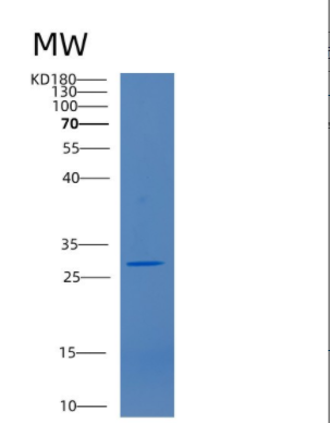 Recombinant Human CD38 Protein,Recombinant Human CD38 Protein