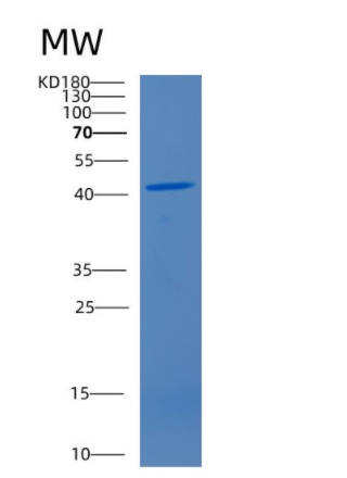 Recombinant Human CD4 Protein,Recombinant Human CD4 Protein