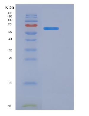 Recombinant Cluster Of Differentiation 40 Ligand (CD40L),Recombinant Cluster Of Differentiation 40 Ligand (CD40L)