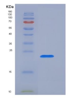 Recombinant T-Cell Surface Glycoprotein CD3 Epsilon (CD3e),Recombinant T-Cell Surface Glycoprotein CD3 Epsilon (CD3e)