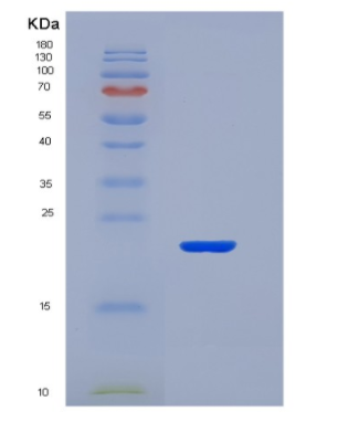 Recombinant Tumor Necrosis Factor Receptor Superfamily, Member 5 (CD40),Recombinant Tumor Necrosis Factor Receptor Superfamily, Member 5 (CD40)