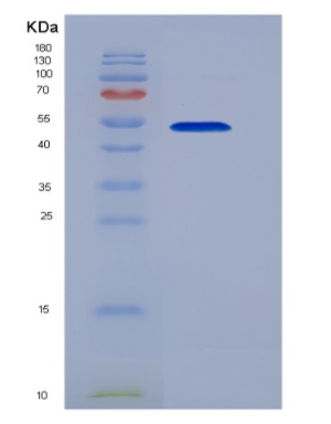 Recombinant Cluster Of Differentiation 58 (CD58),Recombinant Cluster Of Differentiation 58 (CD58)