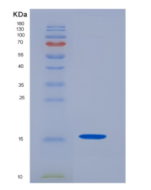 Recombinant Cluster Of Differentiation 7 (CD7),Recombinant Cluster Of Differentiation 7 (CD7)