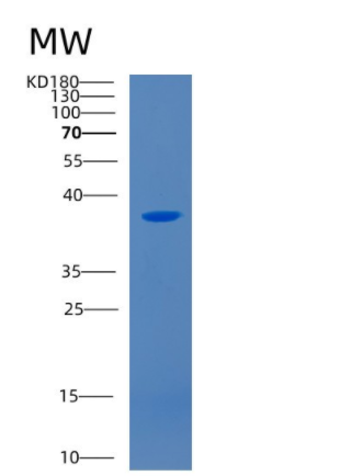 Recombinant Human CD46 Protein,Recombinant Human CD46 Protein