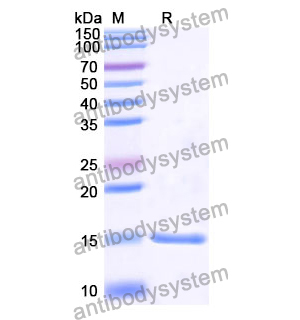 抗 Human CTNNB1 纳米抗体 (SAA1197)(RHE07601),Anti-Human CTNNB1 Nanobody (SAA1197)