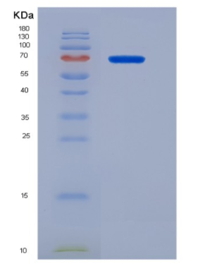 Recombinant Human CD68 Protein,Recombinant Human CD68 Protein