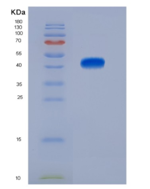 Eukaryotic Cluster Of Differentiation 74 (CD74),Eukaryotic Cluster Of Differentiation 74 (CD74)