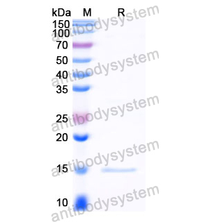 抗 Human CTNNB1 纳米抗体 (SAA1410)(RHE07603),Anti-Human CTNNB1 Nanobody (SAA1410)